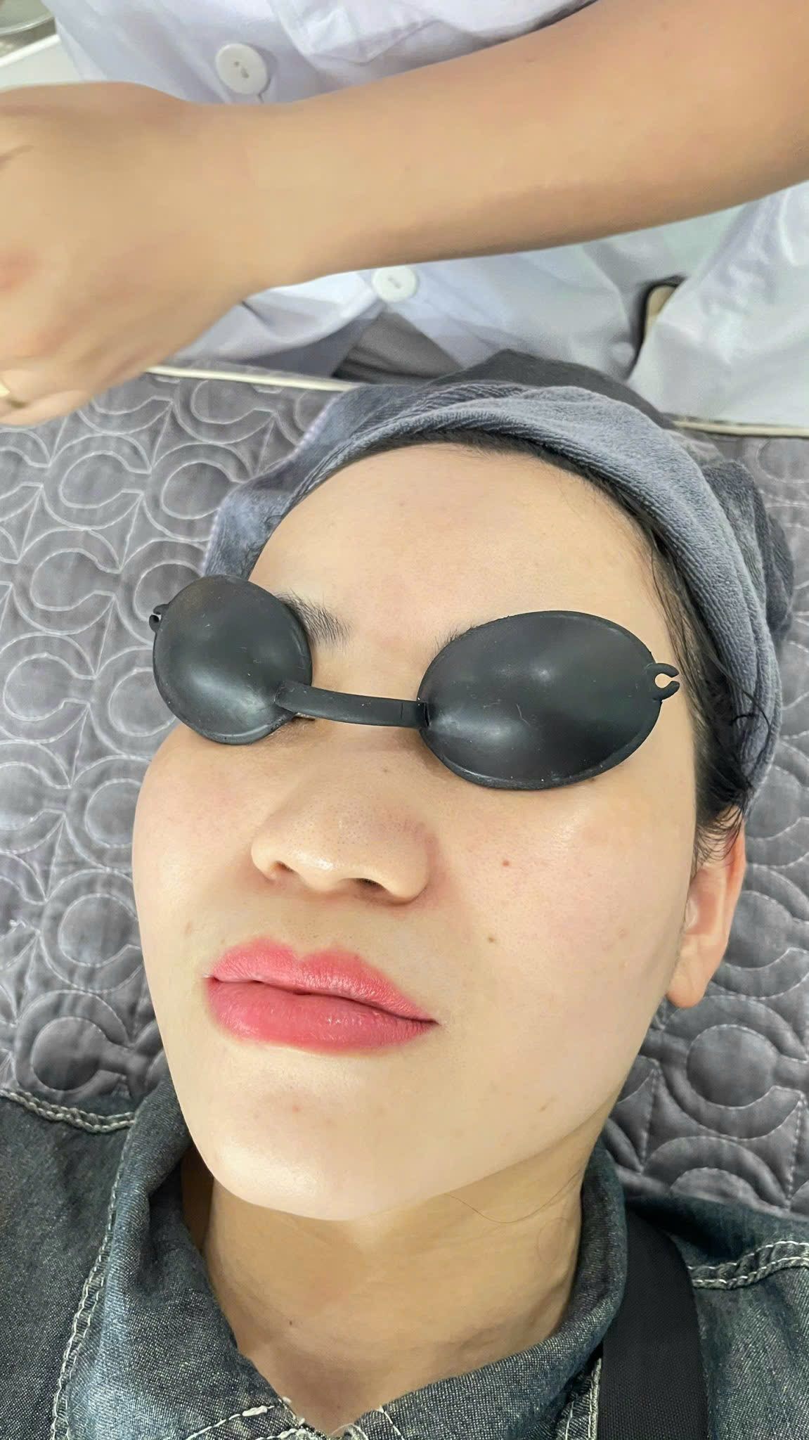 Liệu trình chăm sóc da an toàn tại Sen